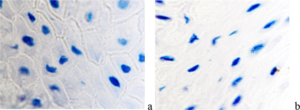 Figure 4 - The wound surface of the skin: a - the prickly layer of the epidermis is normal; b: spiny layer of the epidermis with scarring - intercellular boundaries are not identified. Magnification x 200. Staining with hematoxylin.