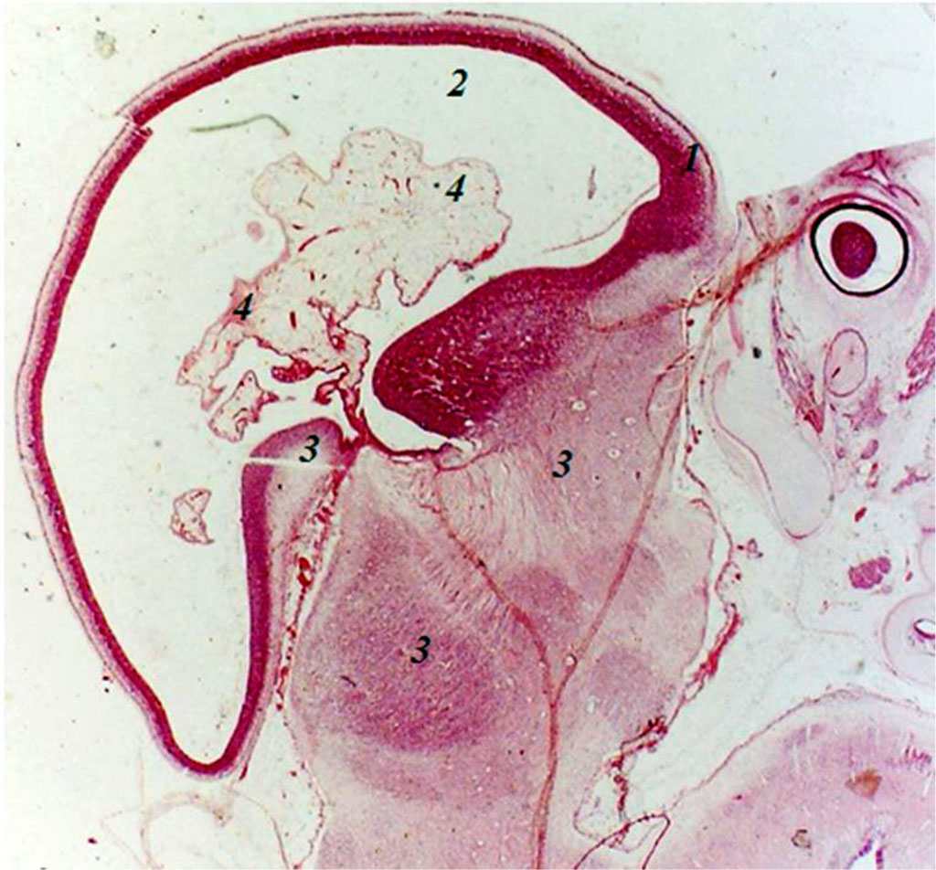 Fig. Sagittal section of the embryo of 8 weeks of intrauterine development: 1 - endbrain wall; 2 - endbrain cavity; 3 - anlages of arterial trunks; 4 - plexiform branching of arterial anlages; 5 – anlage of the eye cup. Increased by 160.
