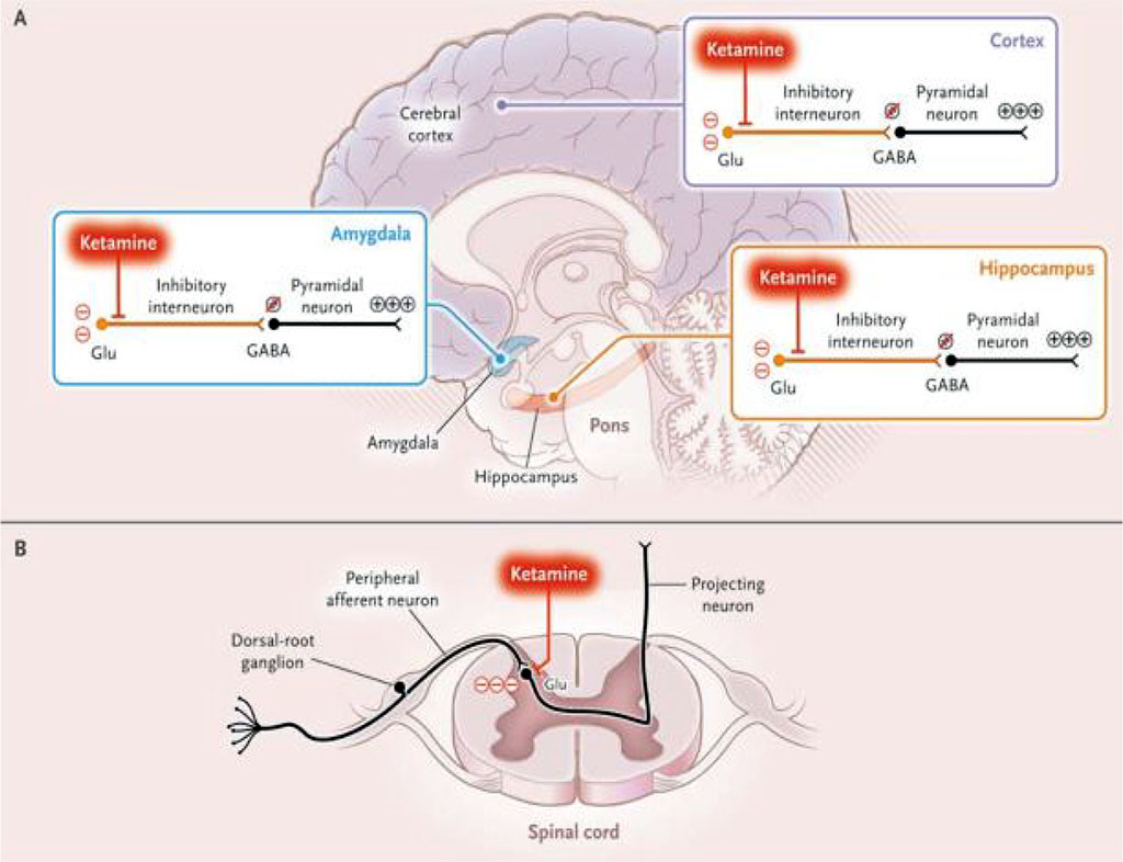 Figure 2 (Brown et al., 2010): Ketamine’s Action Mechanism