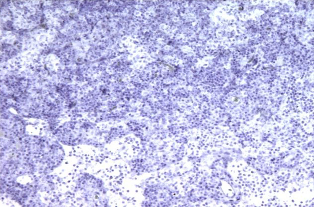 Figure 1. Rat lymph node. Morphological picture on the 3rd day of intramuscular administration of APG. Bcl-2 expression is absent. X100