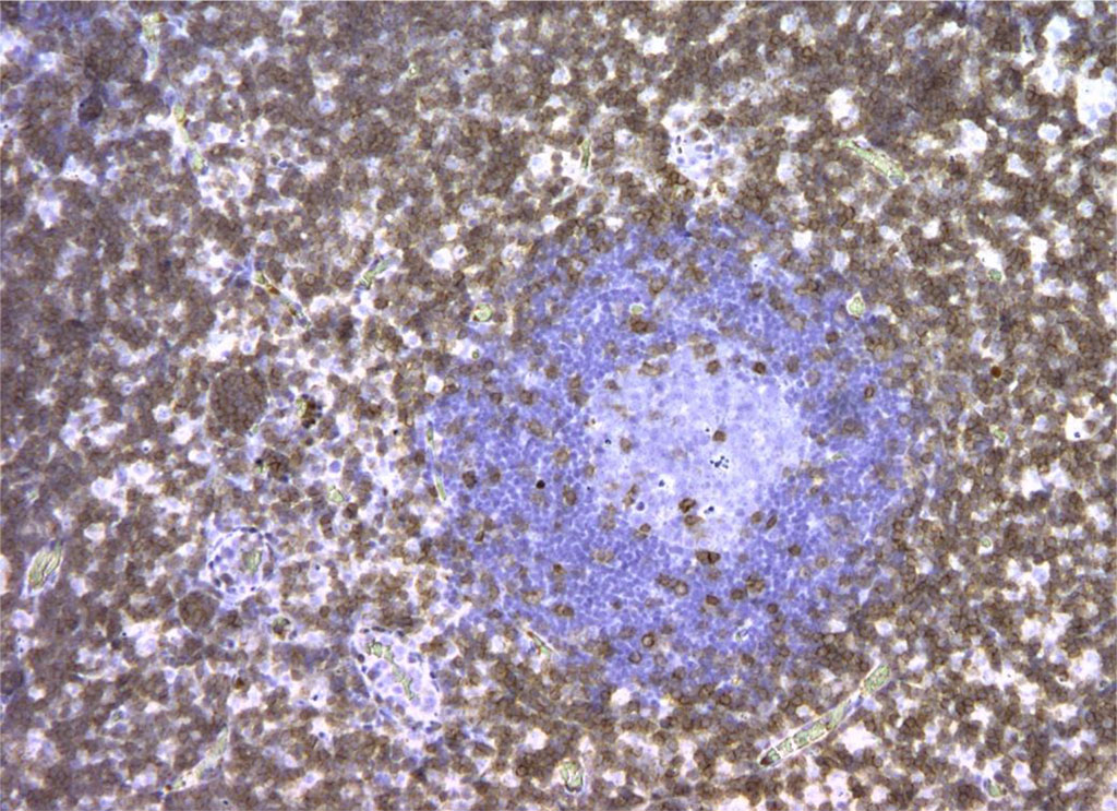 Figure 6. Rat lymph node. Picture on the 3rd day of intralymphatic administration of APG. CD3+ reaction around the “light centers” of 90% of cells. X100