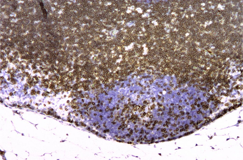 Figure 7. Rat lymph node. 7th day of intramuscular administration of APG. CD3+ staining is present mainly in the cortex. X100