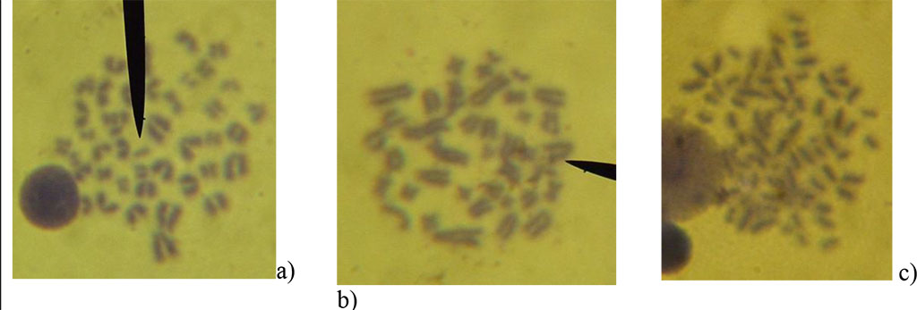 Figure 3. Cytogenetic disorders discovered under the influence of technetium: a) double fragment, b) deletion, c) polyploid.