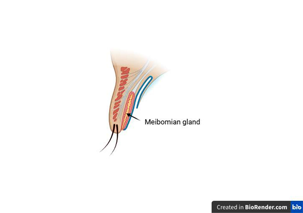 Fig 3. Eyelid anatomy