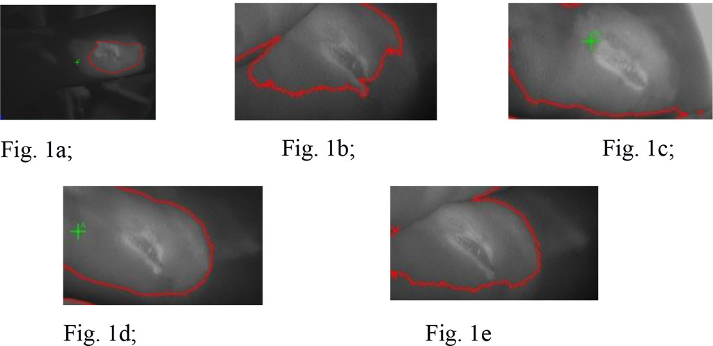 Figure 1. Gel concentration in scar tissue at