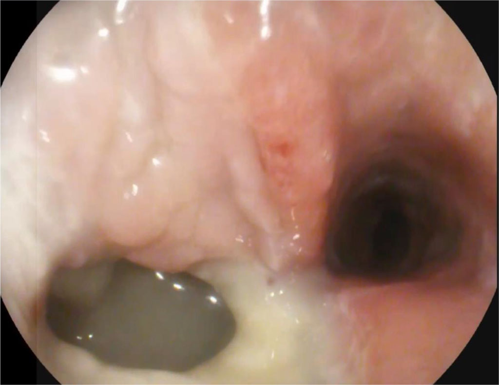 Figure 2. 21 days after surgery (explanations in the text)