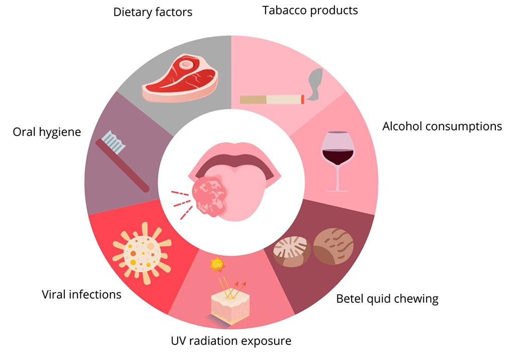 Figure 1. Risk factors for development of oral cancer