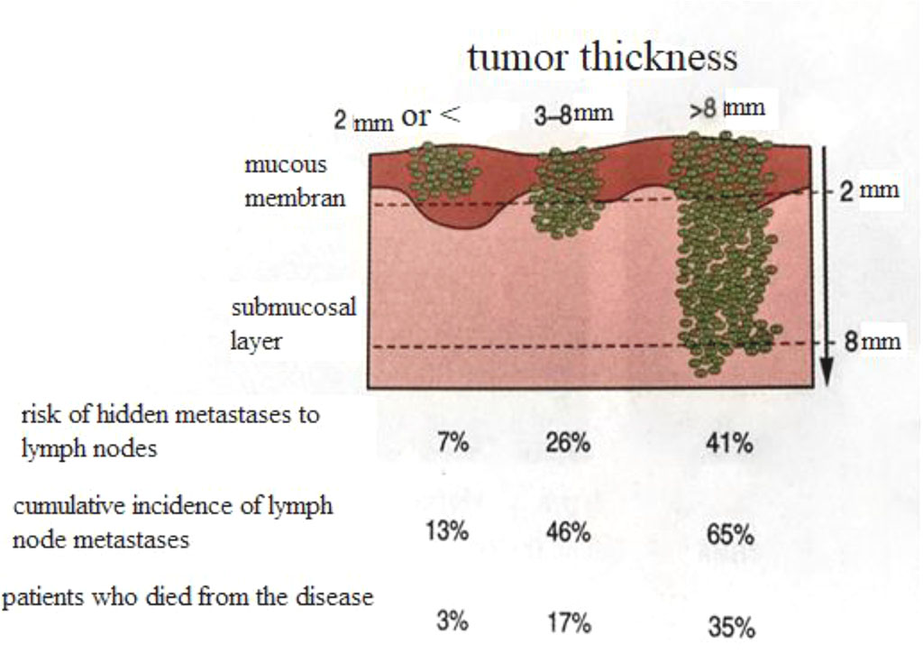 Fig. 1. Scheme of correlation of tumor thickness with its metastatic potential.